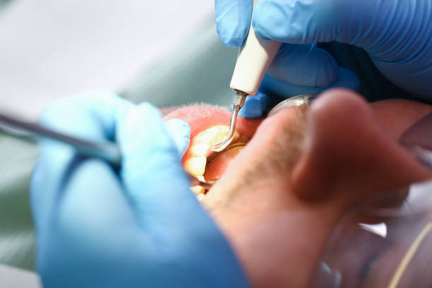 Best Emergency Treatment for Dental Infections or Abscesses in Waterloo, NE
